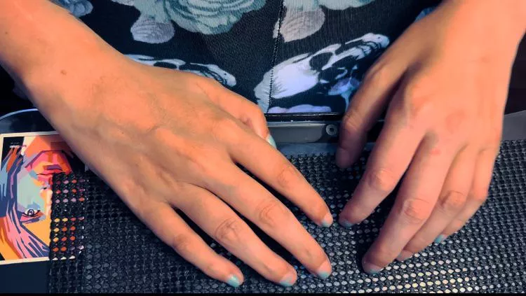 Quadriplegic curled hands. Video available… posted by TitsonwheelsQuad4u