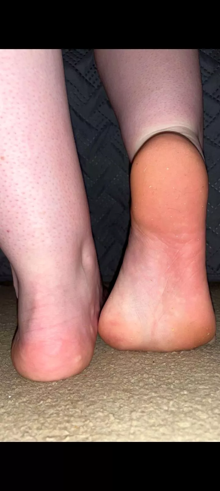 Who would lick these dirty soles clean for me?😈👅 posted by JasminesKingdom