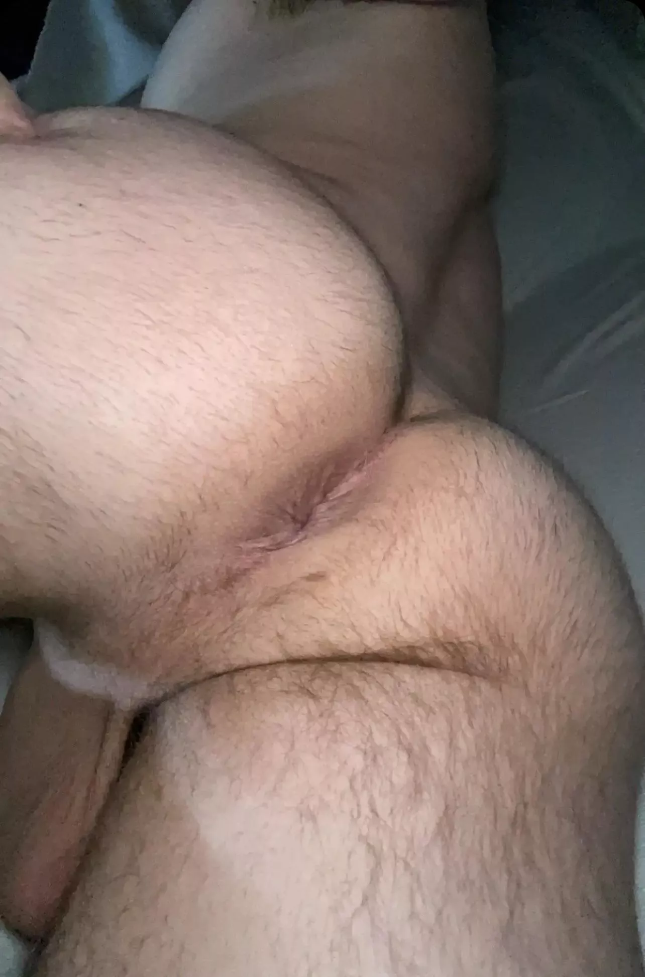 28. Growing into my hair. What do you think? posted by Verspoler