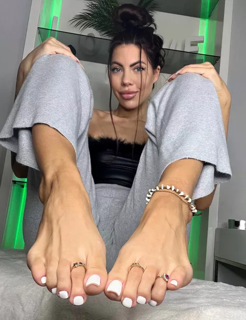 I just got my toes done for Valentine's.. what do you think? OC by Flimsy-Addendum-3139