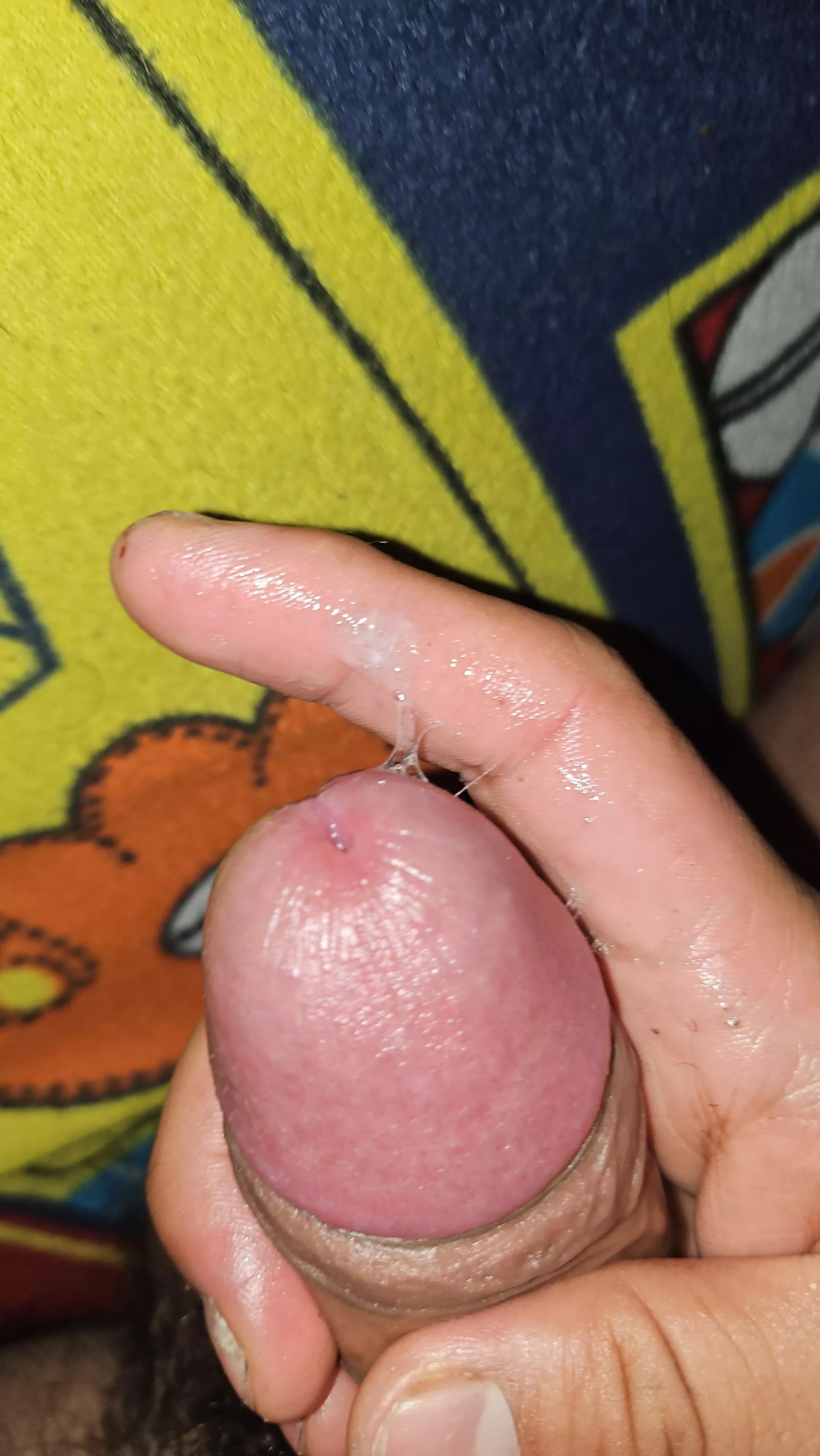 Me empieza a salir mucho de repente posted by Viniciovincio