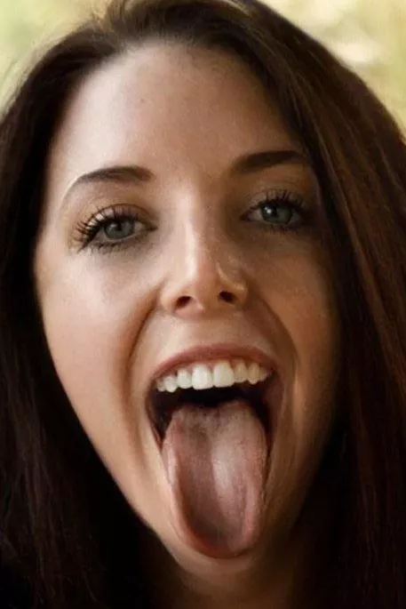 Say ahhhhh posted by Gooneruk69