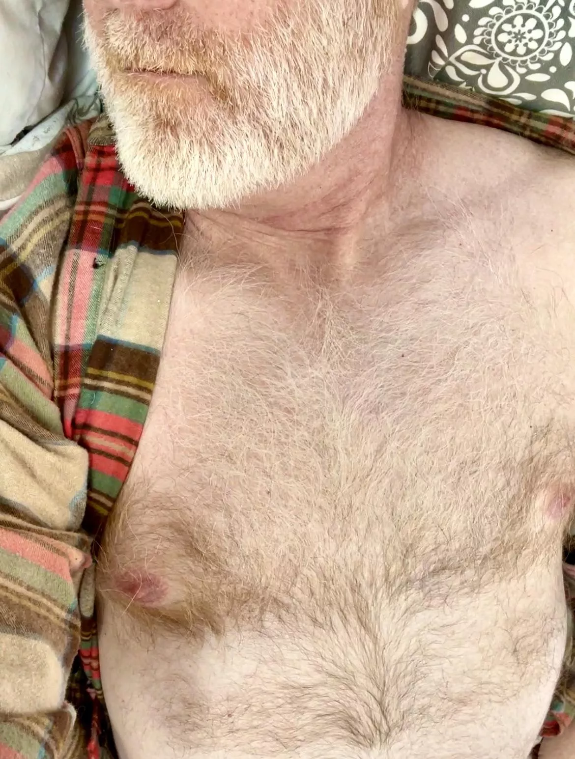 I hope you like fuzzy gingers. posted by TigerNextDoor