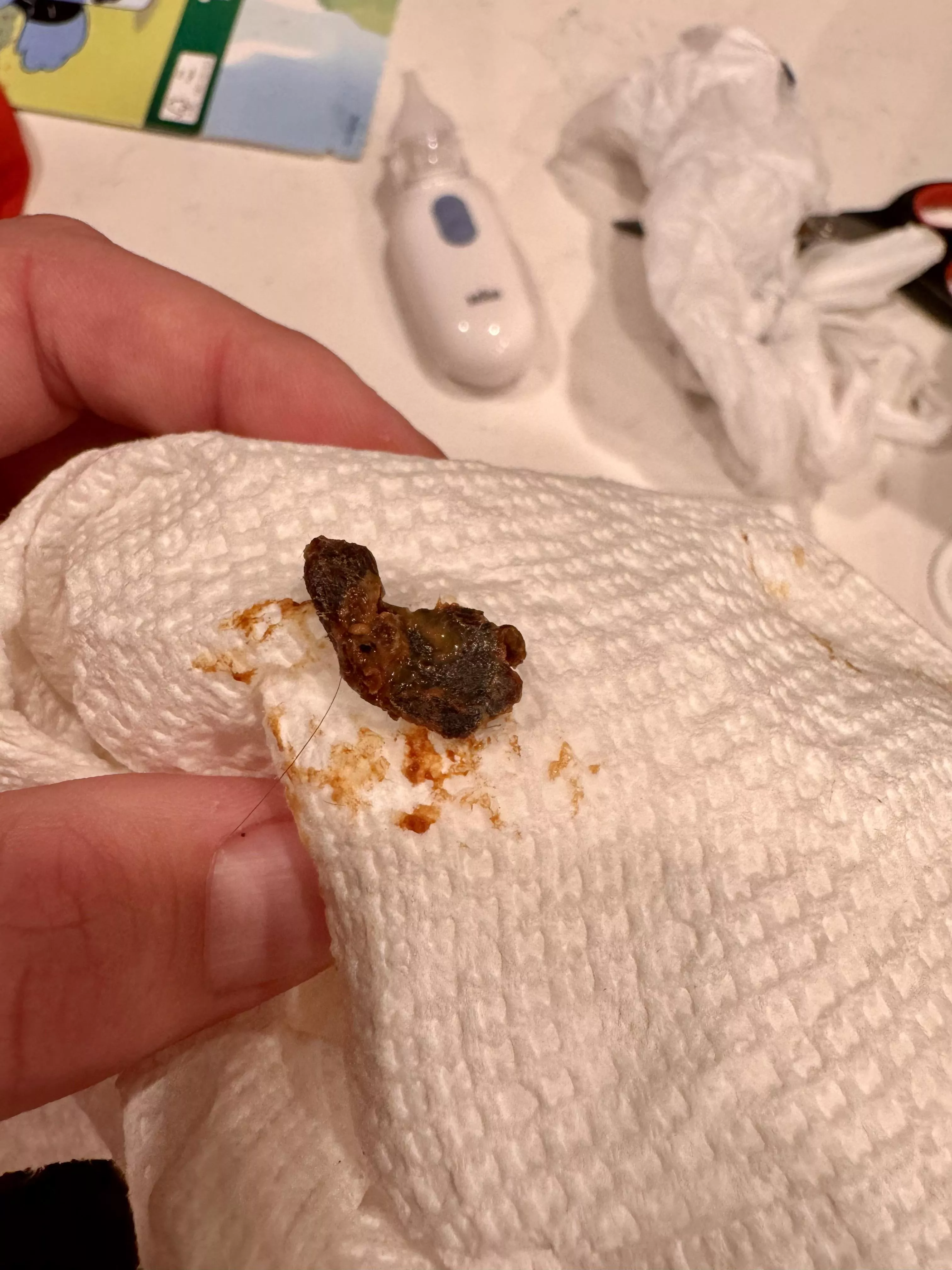 Earwax removal. I use earplugs at work so I’m always dealing with wax compactions. posted by Mesm3rized