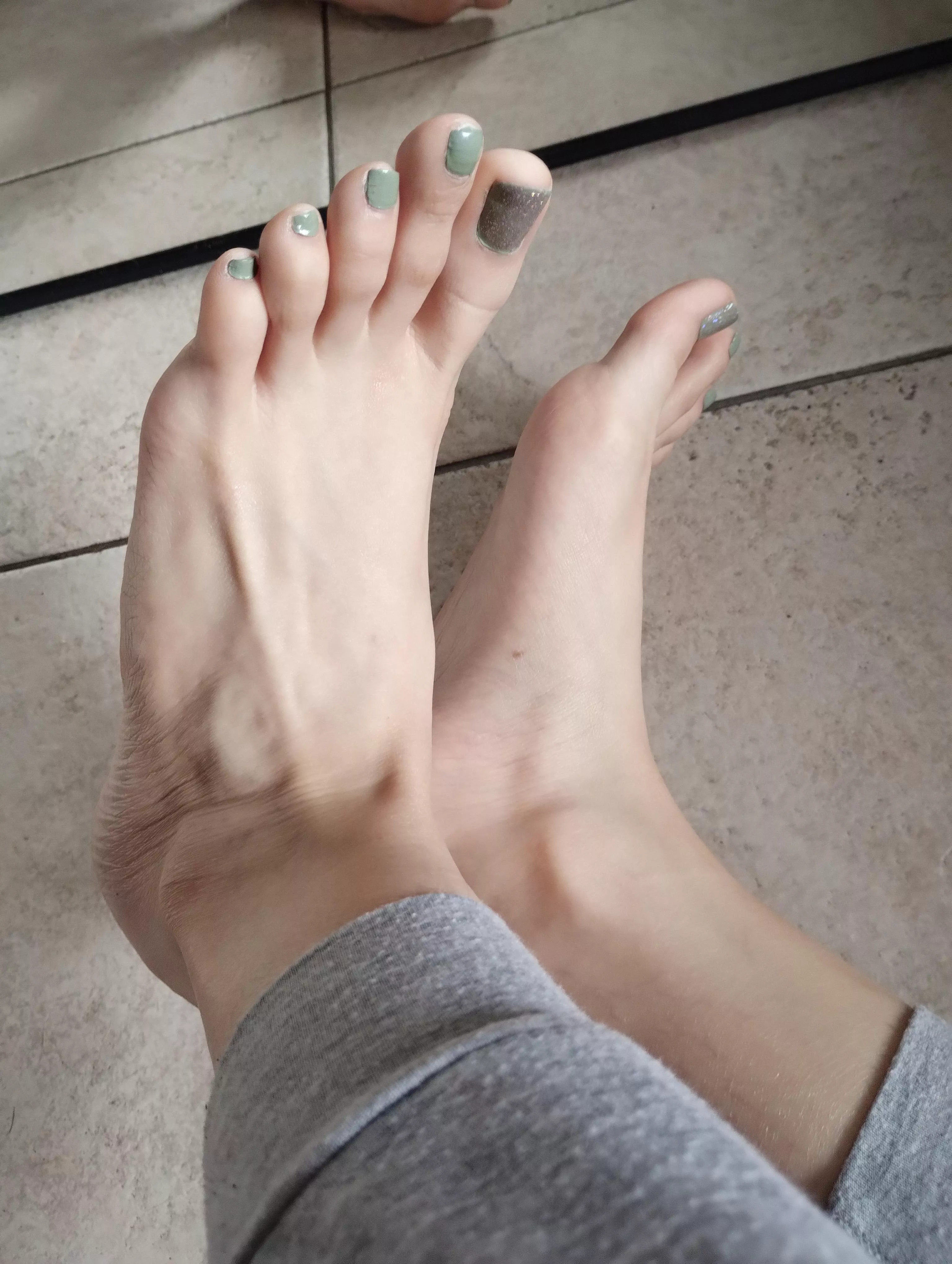 Fingers toes 👣 posted by Beneficial_Earth1858