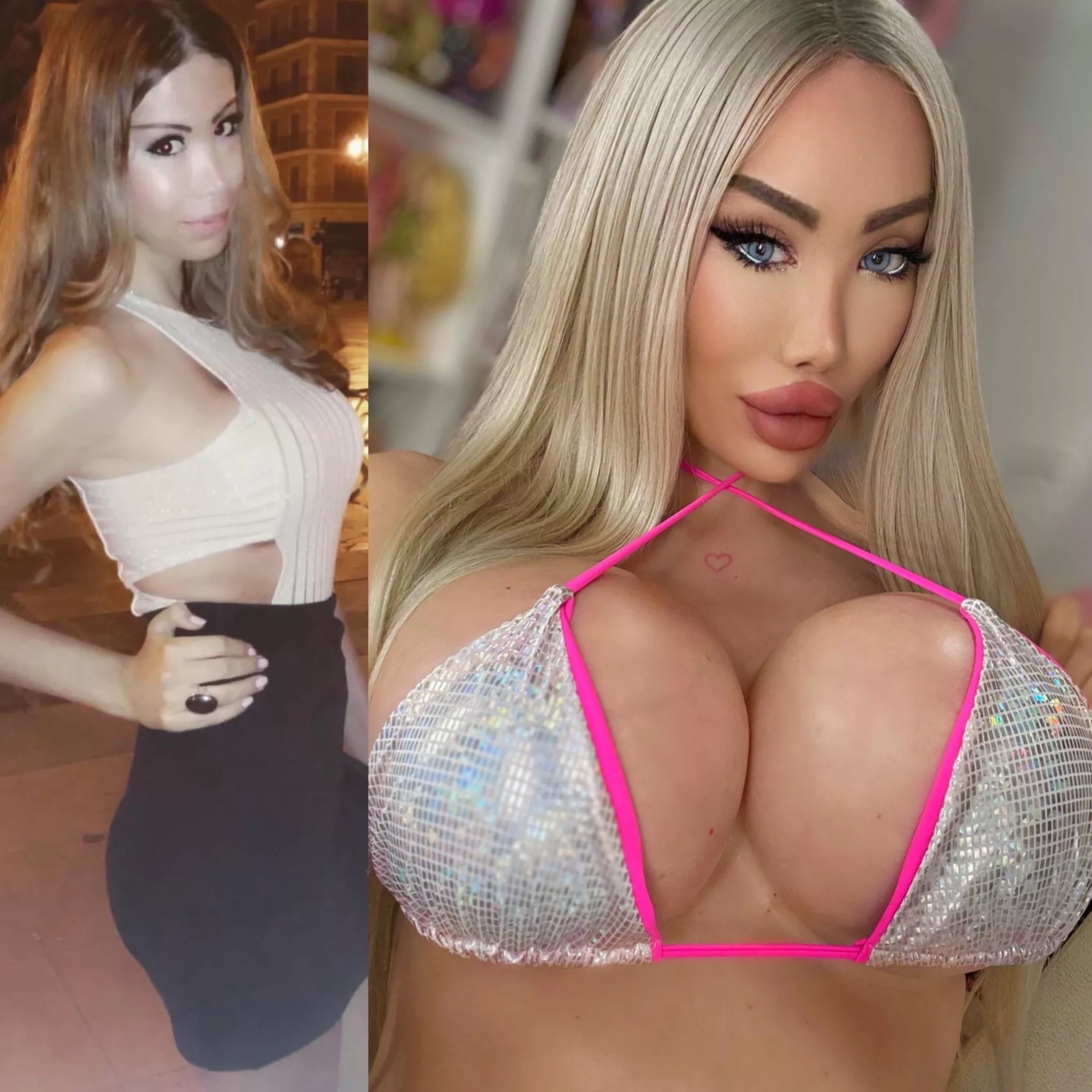 My boobs take up all the space now, and I love it posted by Luxury_Plastic_Doll