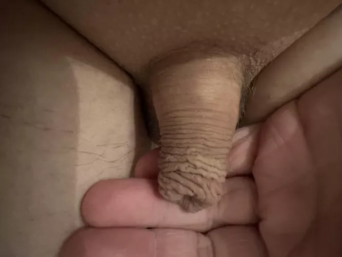 My uncut micropenis by Furrypornalt6969
