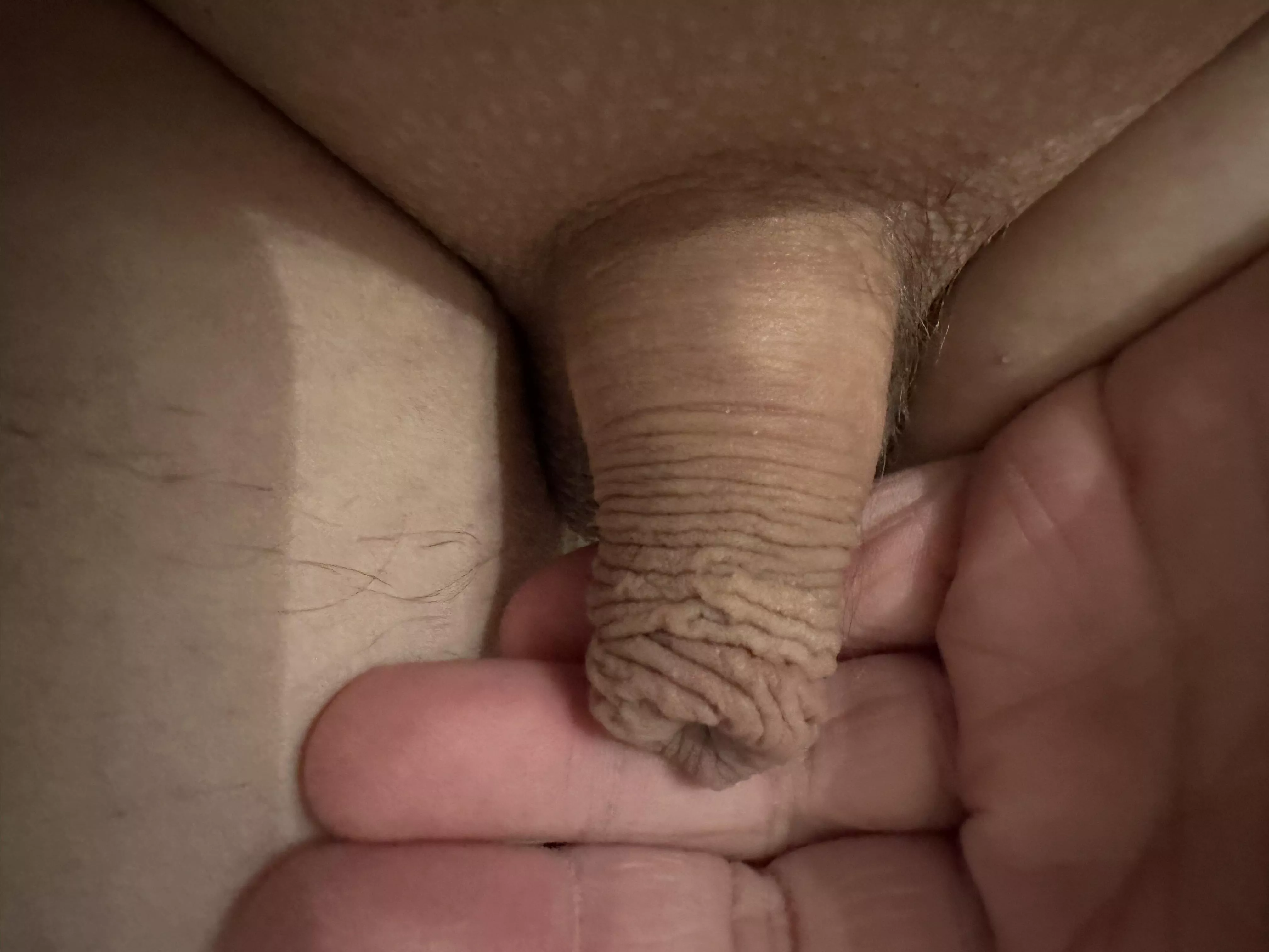 My uncut micropenis posted by Furrypornalt6969