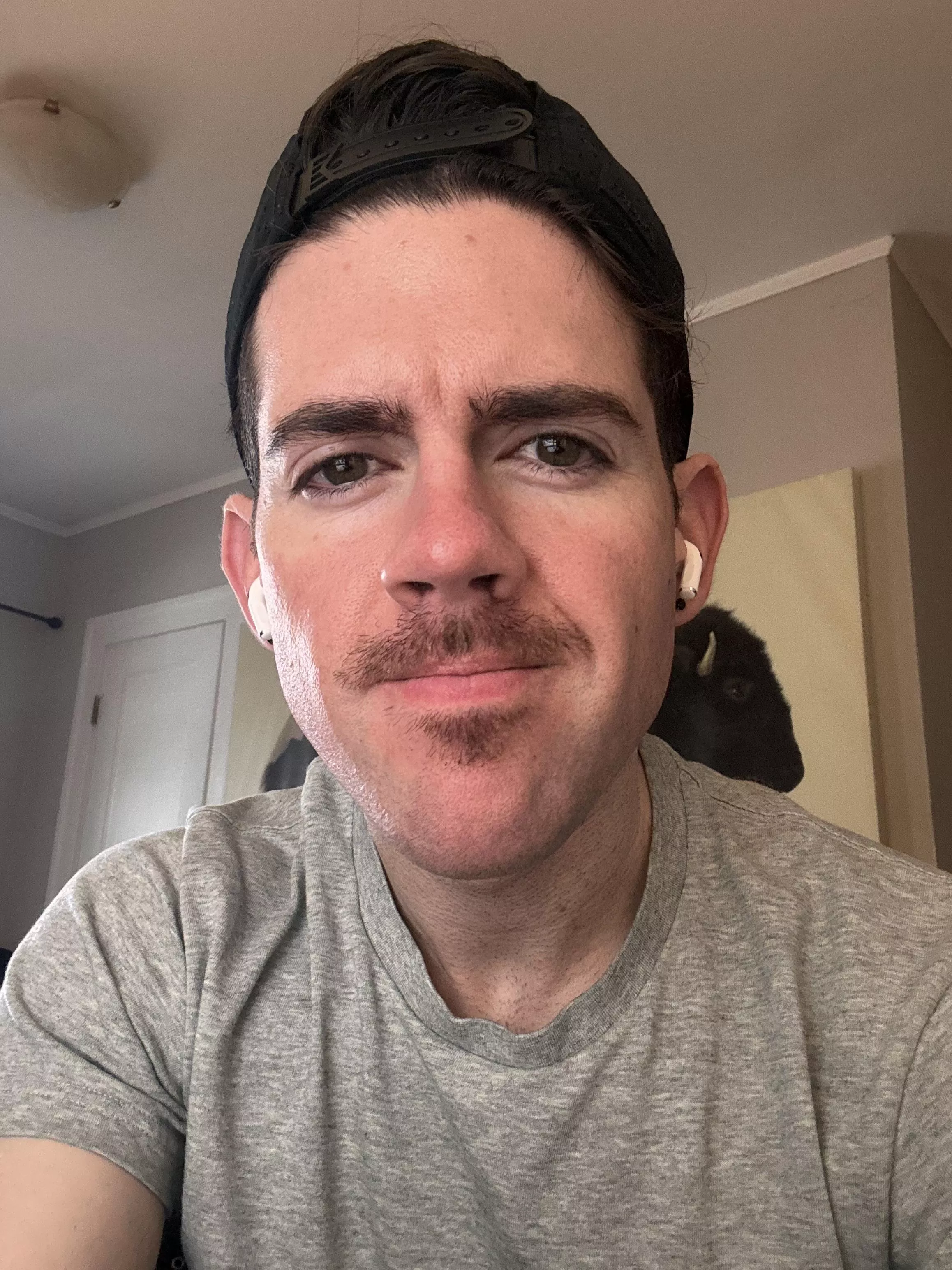 Should I keep my lip patch and just rock a mustache? posted by Enough_Ad_2696