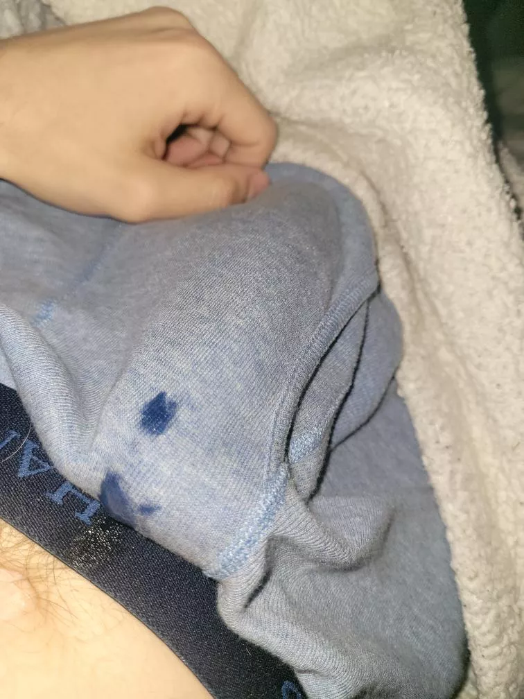 Woke up like this  posted by BigWhiteJewishDick