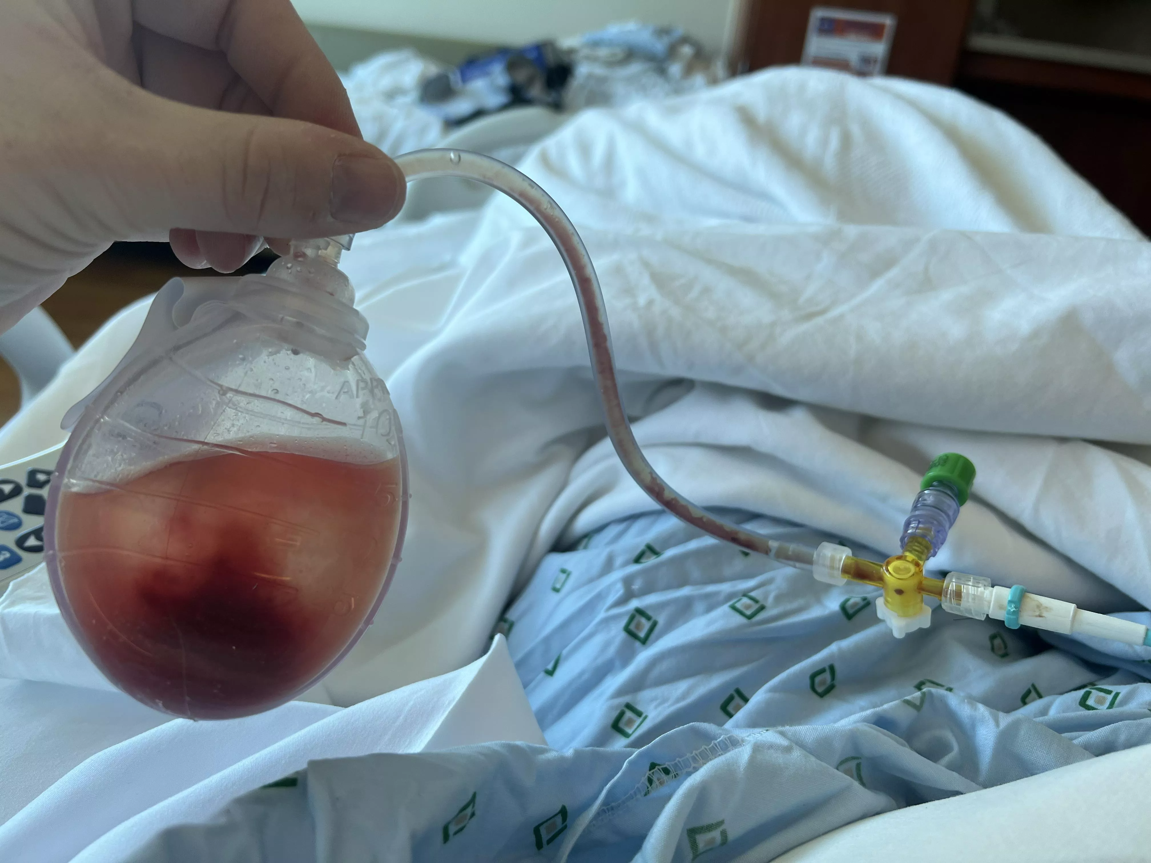 Juice of the most forbidden of forbidden pops. posted by Responsible-Use-9508