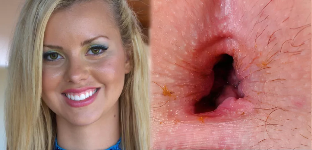 Pretty face, pretty hole by Destined2SuckAsshole