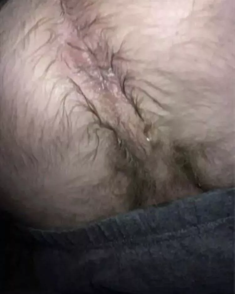 36 m uk Cumdump looking for anon loads posted by LividWerewolf4063