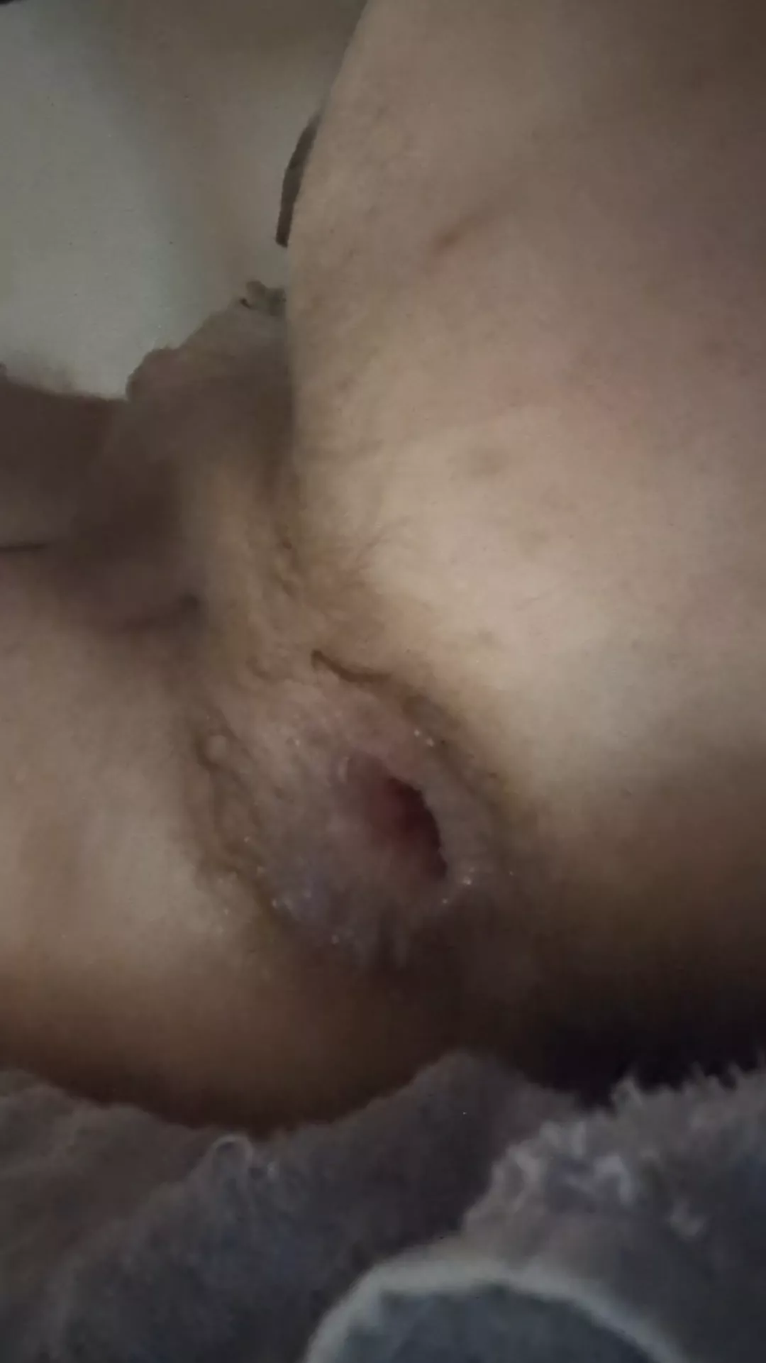 My gaping hole posted by Own_Knowledge_63