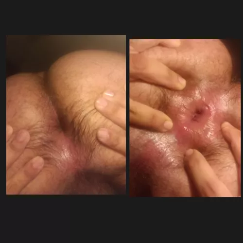 Before and after getting wreck  by elperroflaco