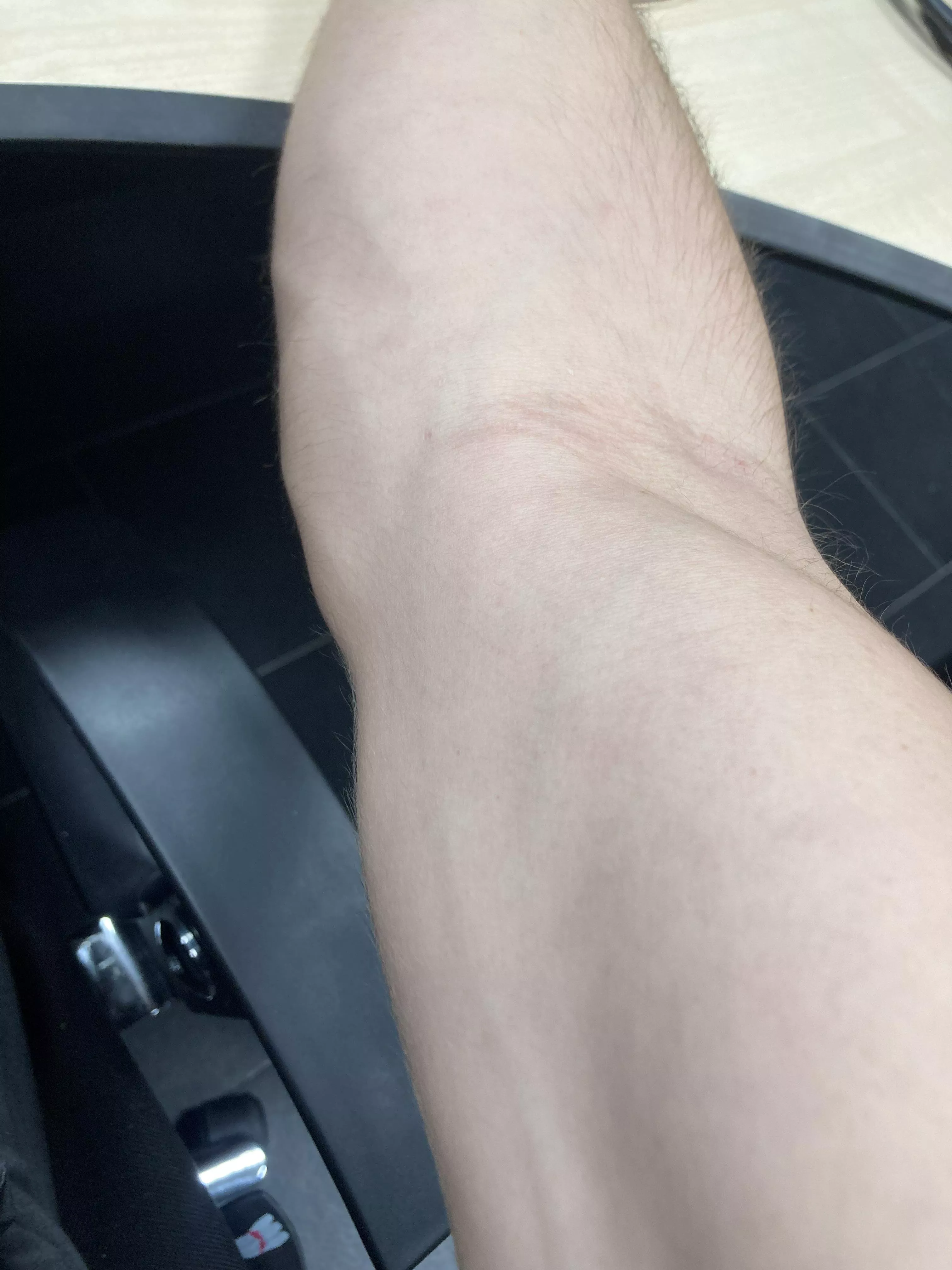 work veins posted by Moonshotsbenny67
