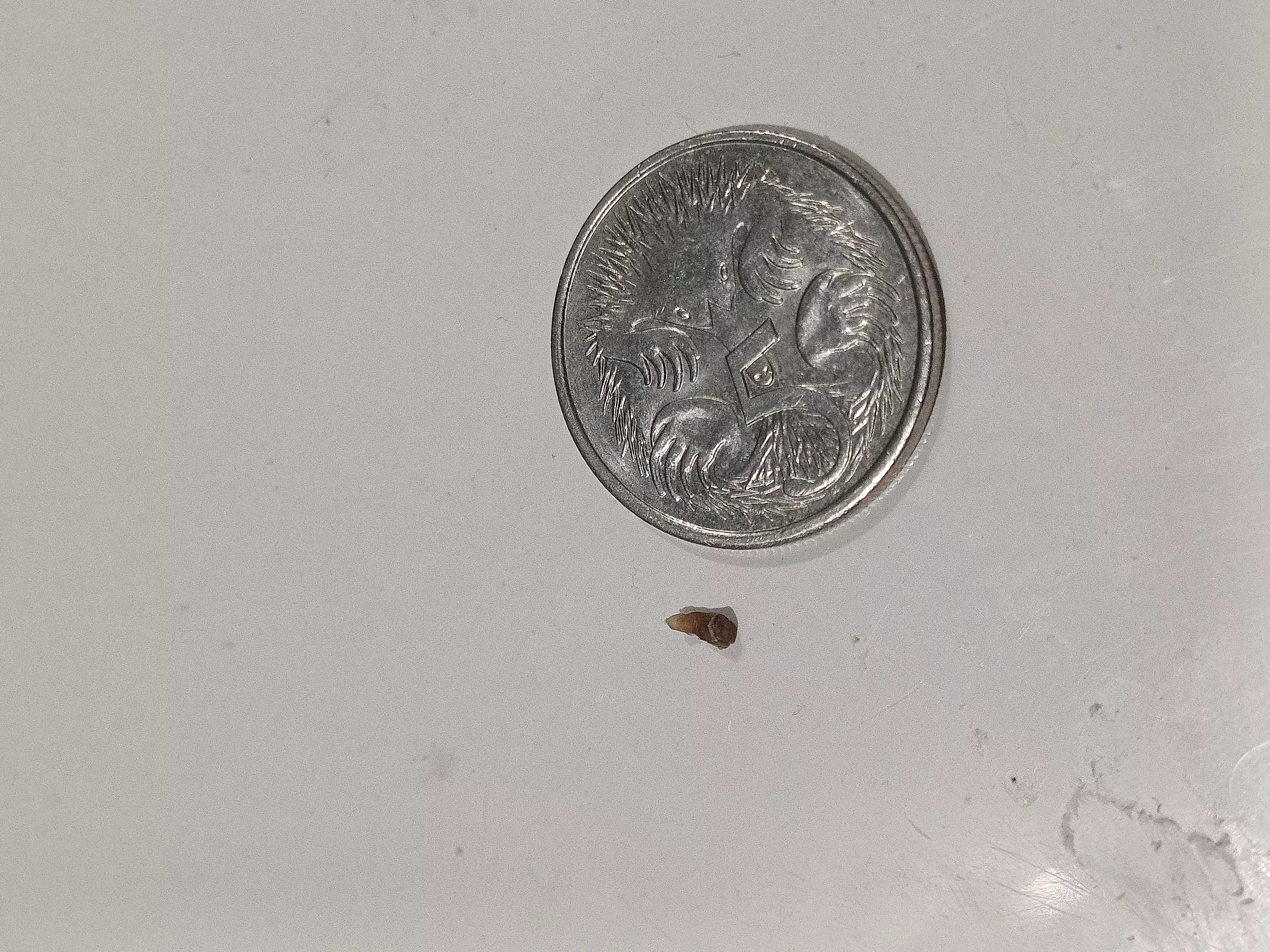 I Just pulled out this big blackhead from my upper back. 5c coin for scale.  posted by Midan71