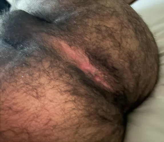 lol by Artistic-Moose754