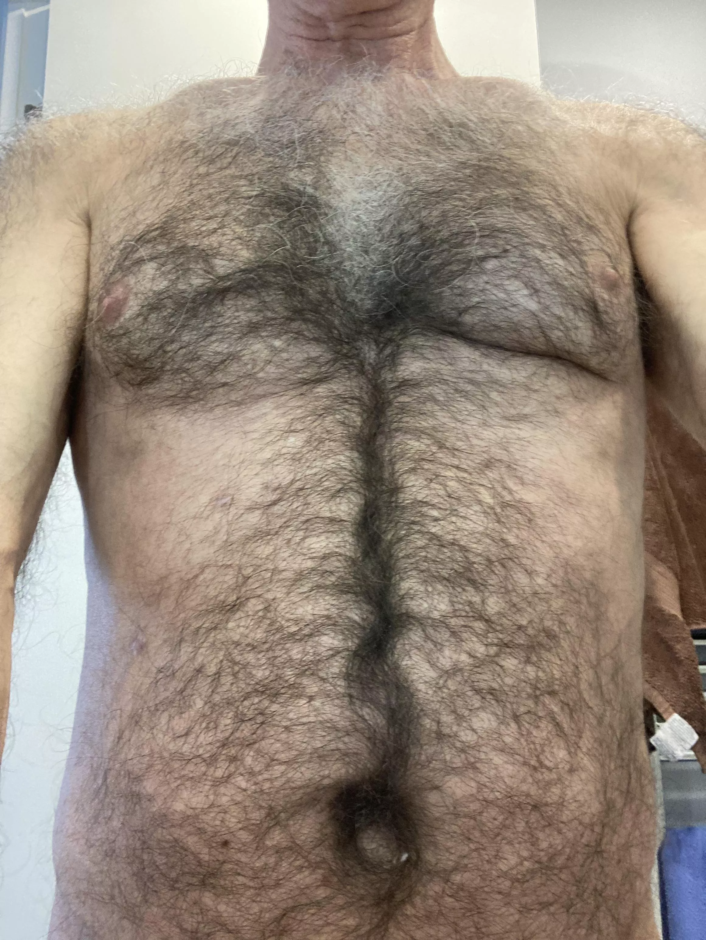 Too Hairy? posted by Neat-Confusion-406