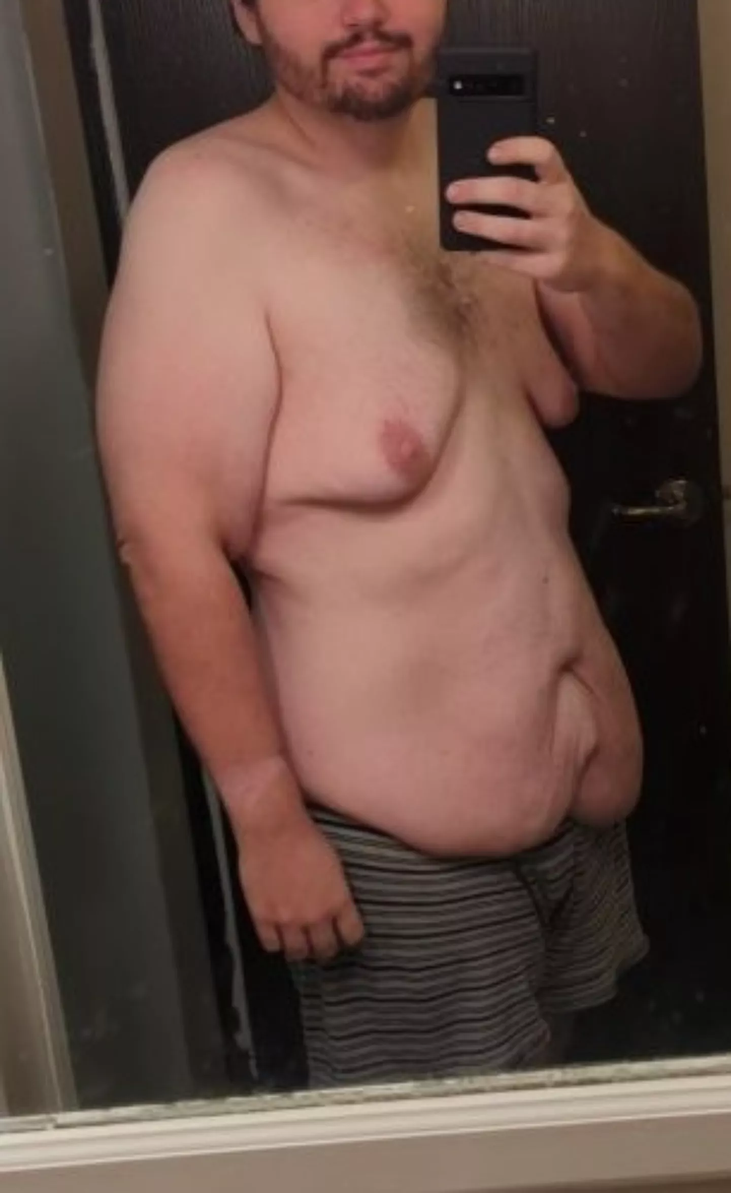 Anyone mind a little extra skin? posted by Darksolarlegend