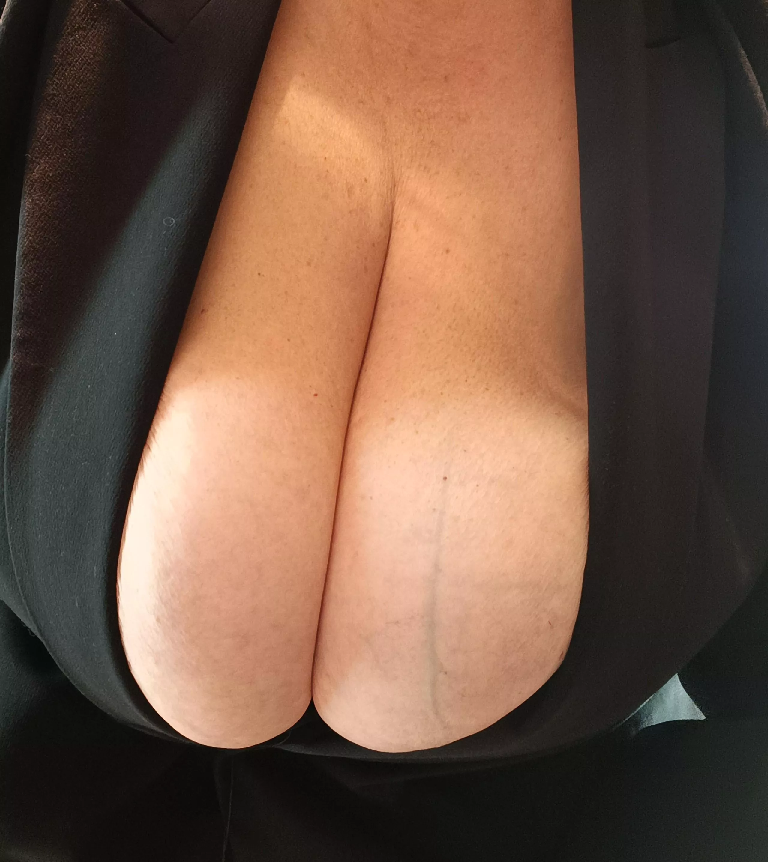 May I be first on your 