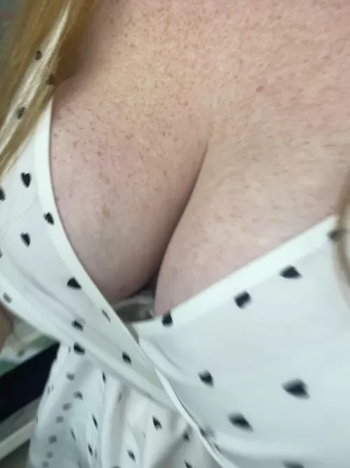 So many freckles! 😊 by RecommendationNo8031