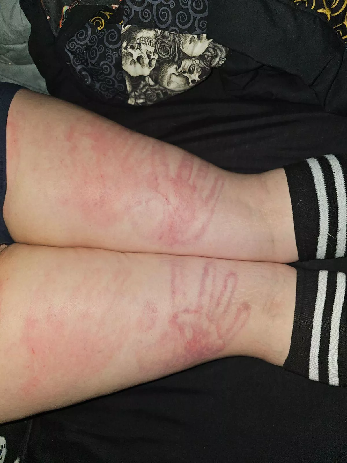 Someone got in trouble... 😈😈😈 posted by psychonaut_kiddo