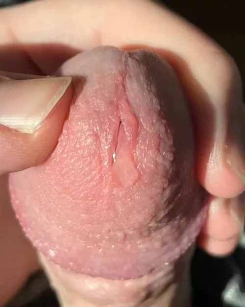 This is only a little bit by Apprehensive_Meat672