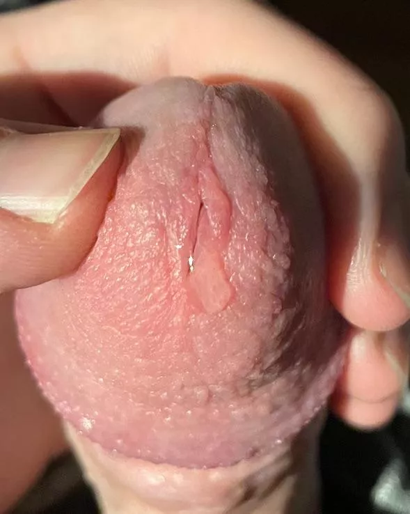 This is only a little bit posted by Apprehensive_Meat672