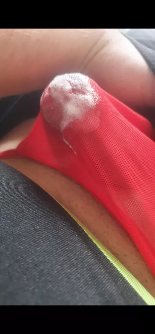 To much rubbing  by No_Mission7545