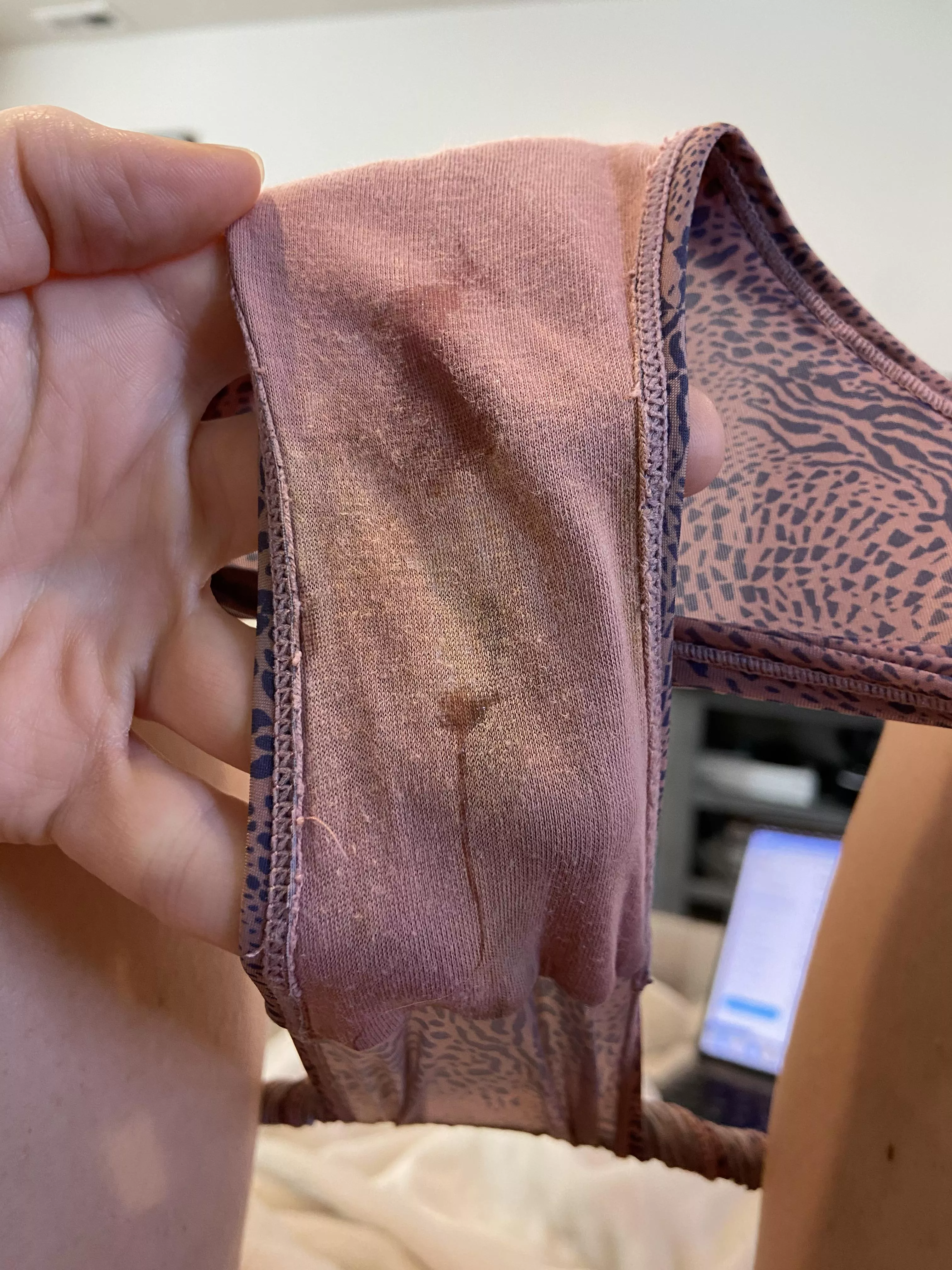 Oozing this morning…help me out?  posted by Sexygirlashley