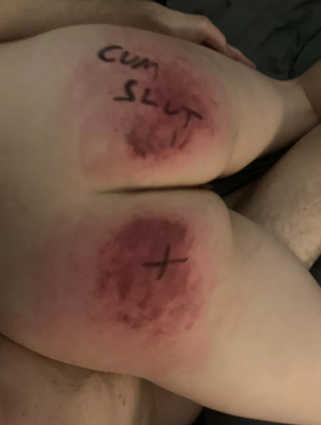 It didn't hurt enough posted by stonedfaerie222