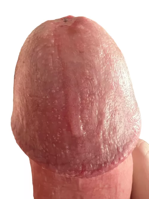 my head up close by NoAbbreviations577