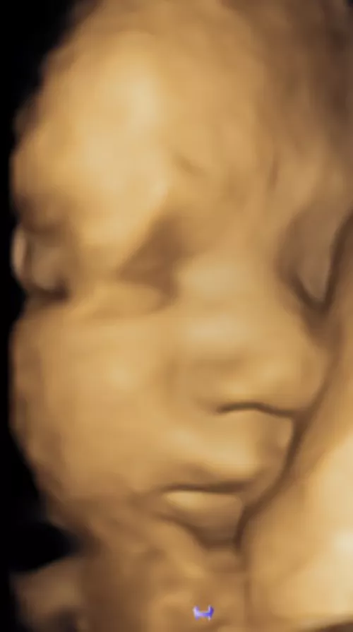 [OC] Update from the couple I helped conceive  by WorldBreeder