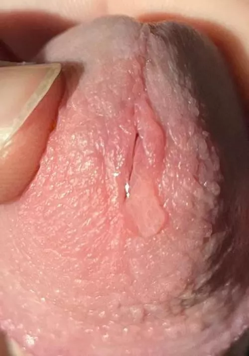 A lot more came out by Apprehensive_Meat672