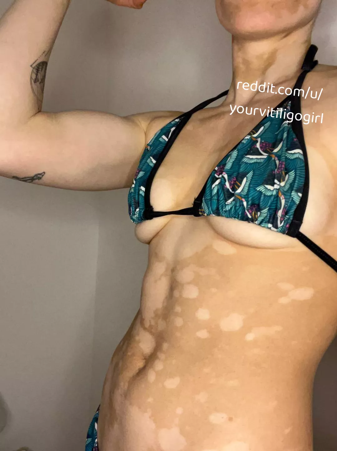 Fit girls are sexy too posted by yourvitiligogirl