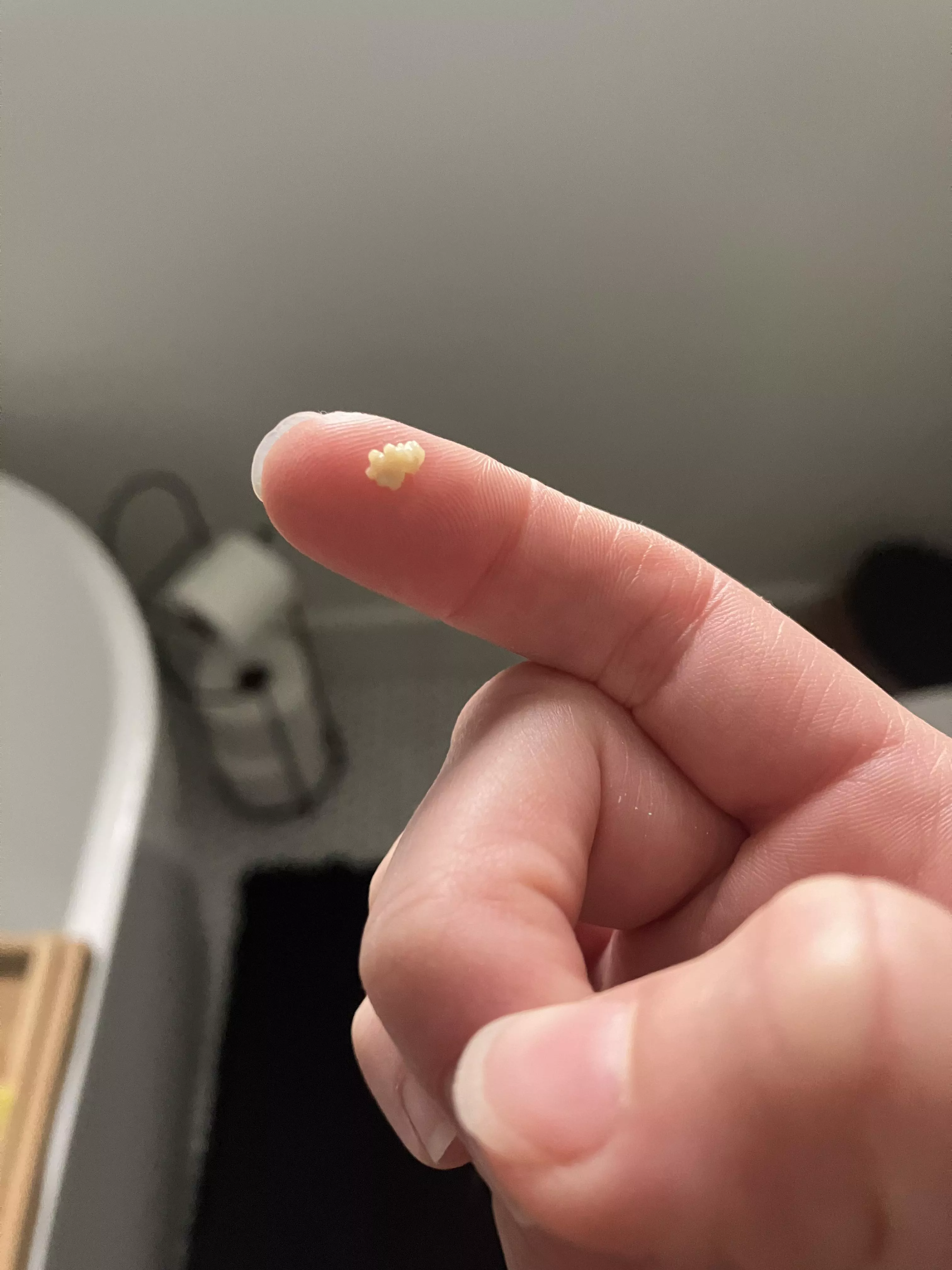 Found this thing hiding 😭 🤢  posted by PsychologicalCut3820