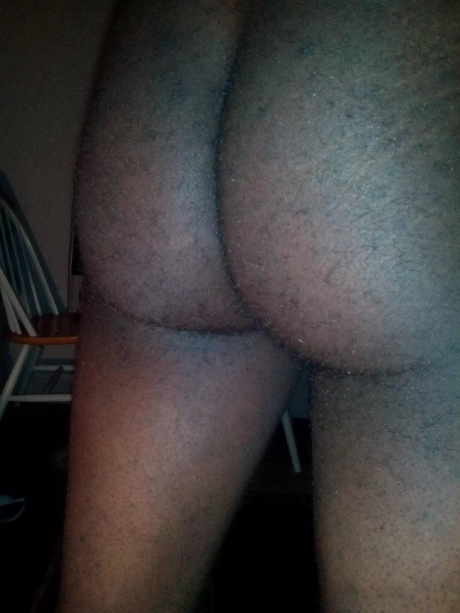 A lil fuzzy here posted by Ok-Cardiologist-4165