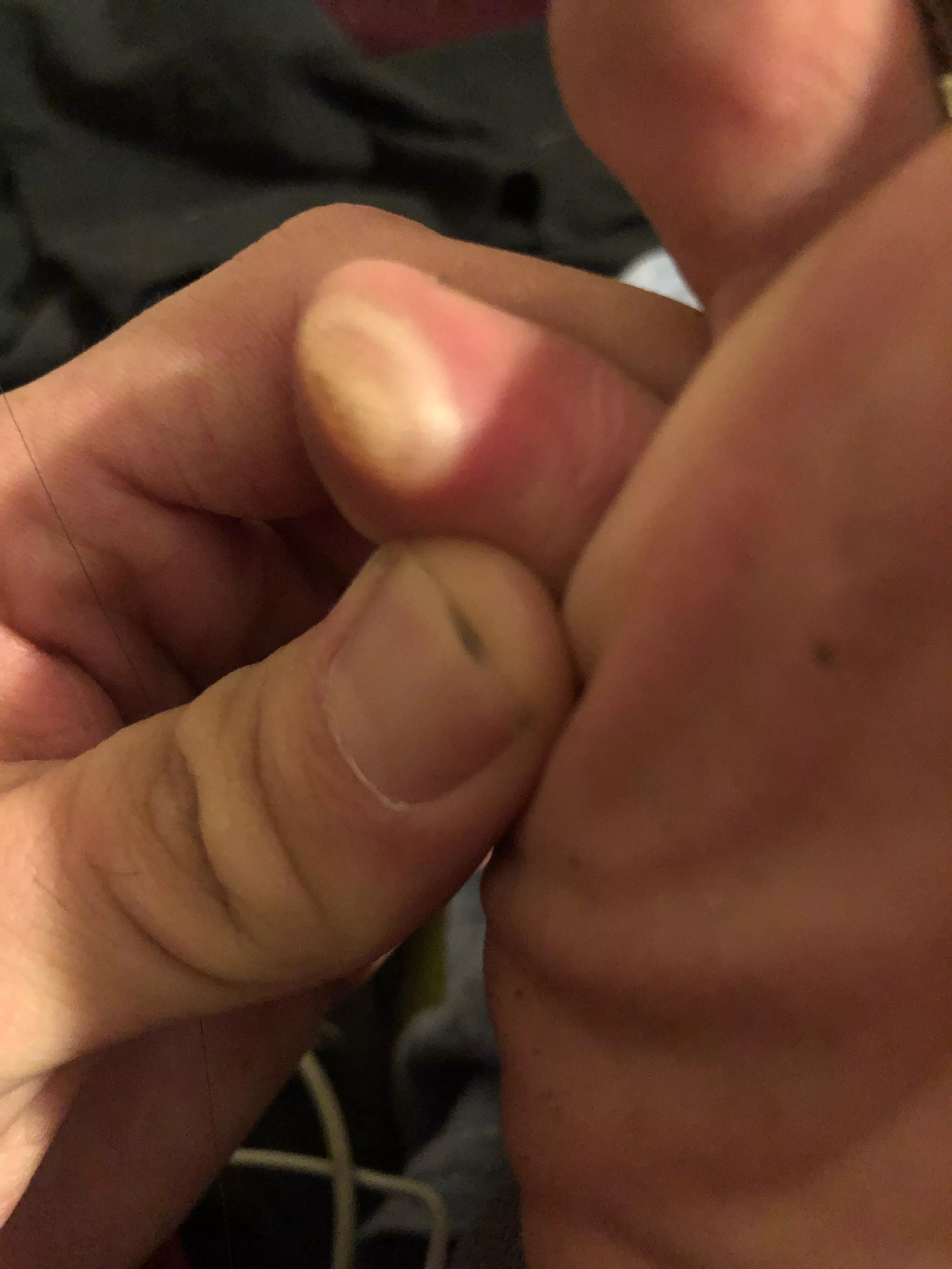 Behold! My basic blister as first tribute to this group posted by zuqwaylh