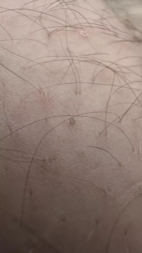 My husband gets what we call “uzumakis” by twodadshuggin