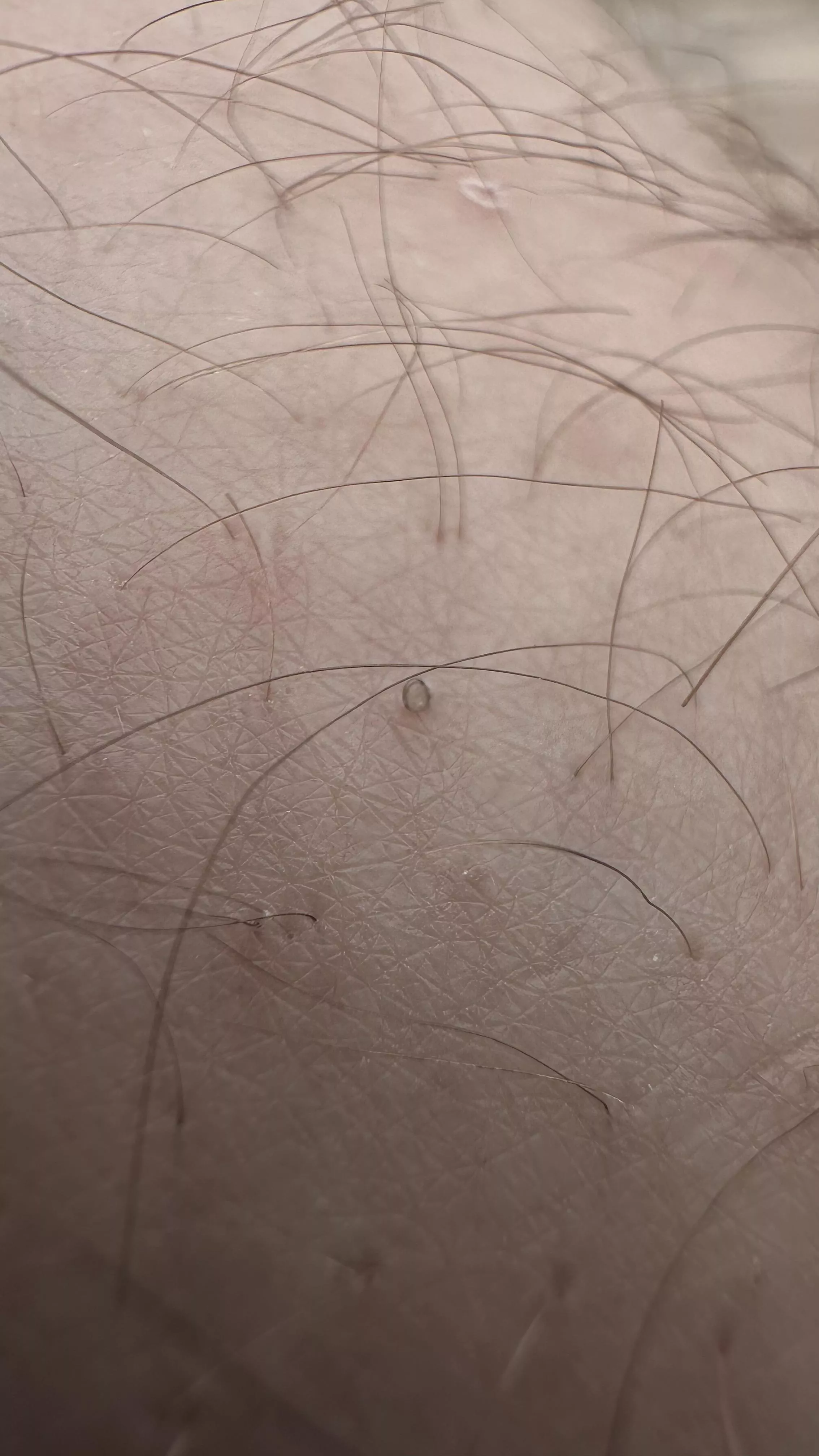 My husband gets what we call “uzumakis” posted by twodadshuggin