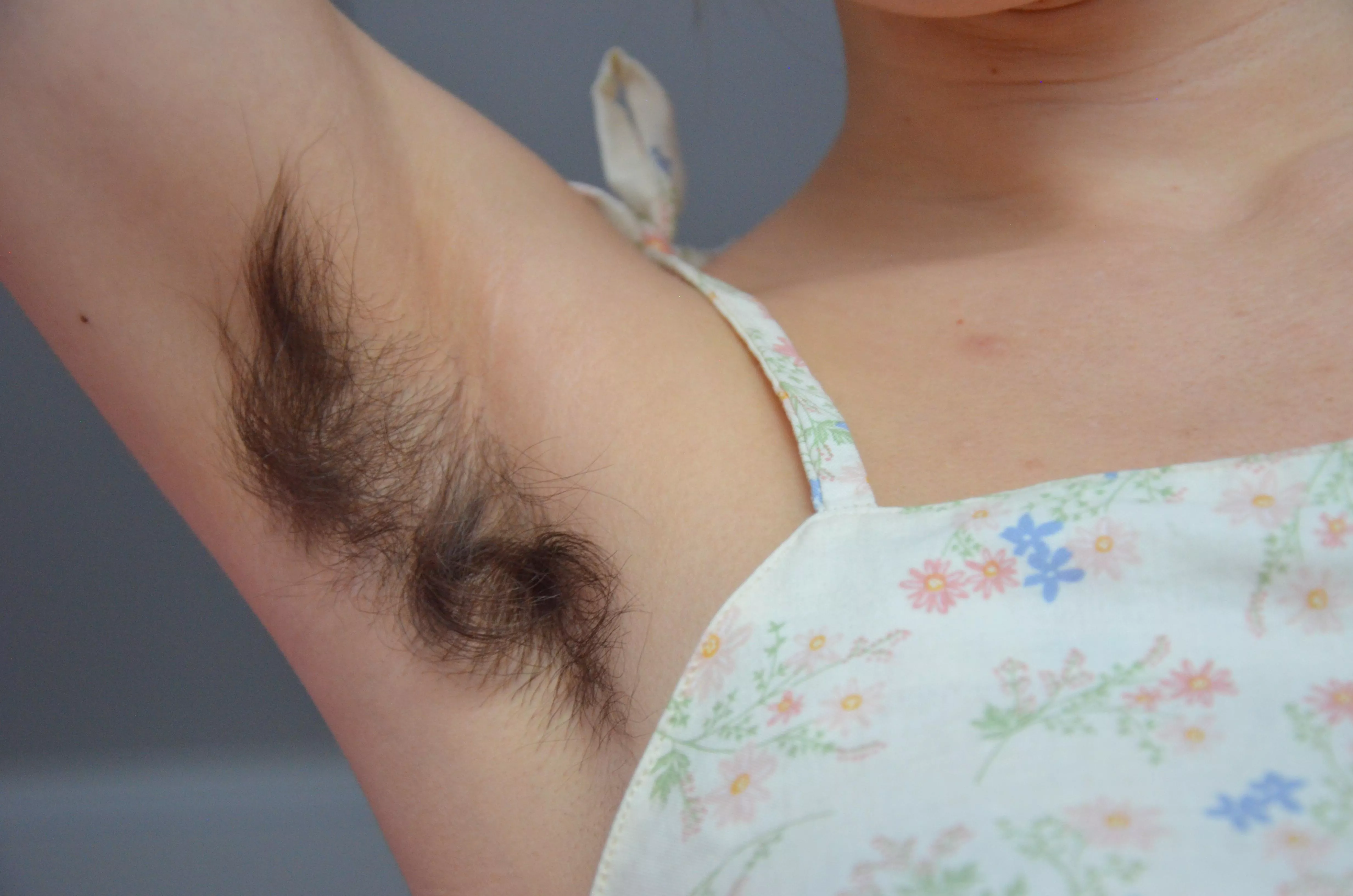 Sorry for the weird question, but do you think my hair looked normal or growing weird?🙈 posted by Creative-Strength-17