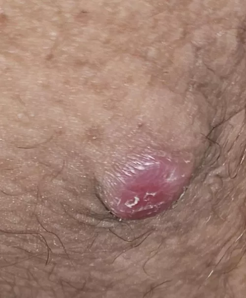 Big boi that i am scared to pop by xxclrbrxx