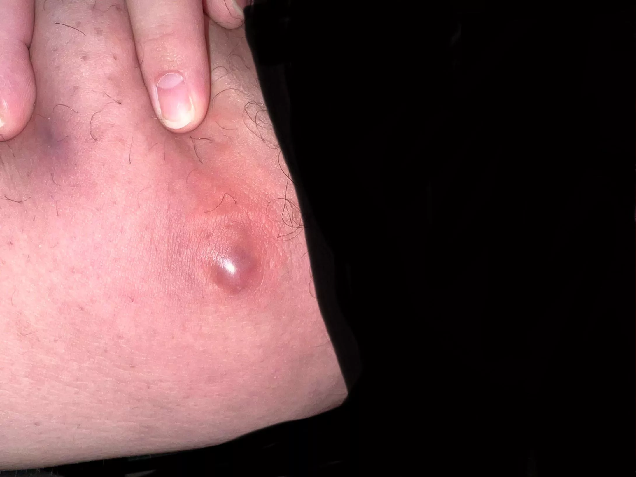 Just fucking pop already posted by TasterOfPork