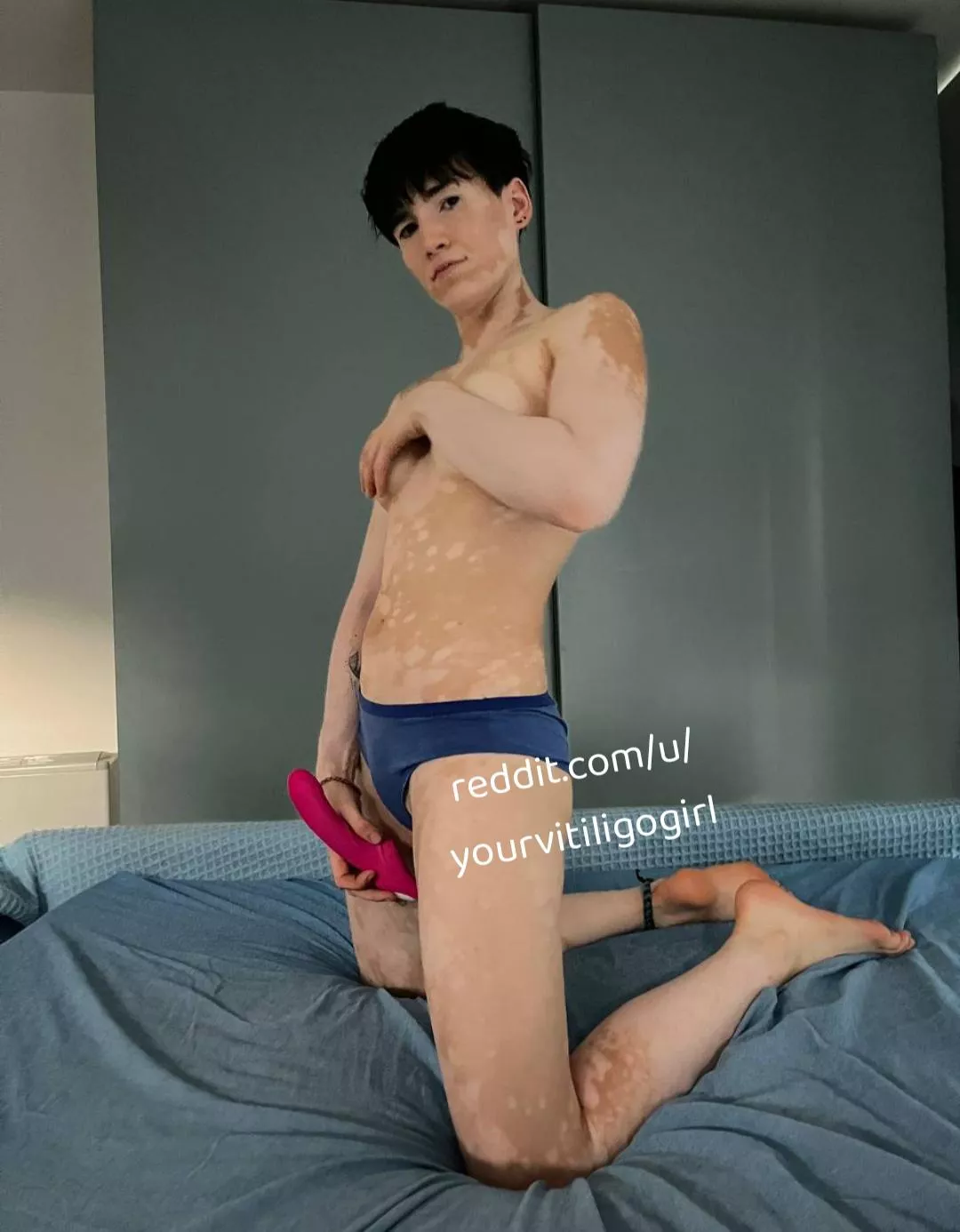 Take It all  posted by yourvitiligogirl