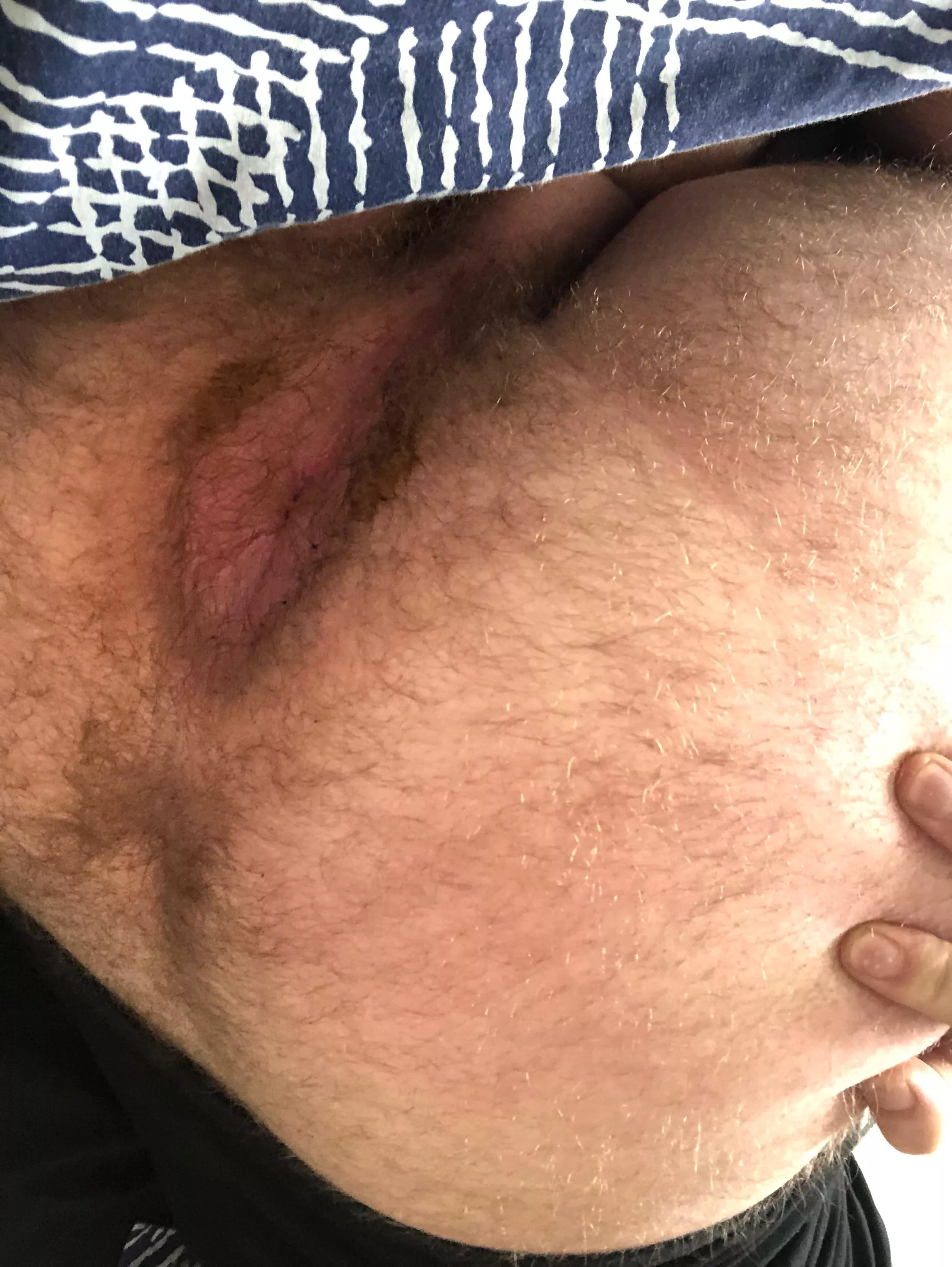 Virgin very hairy posted by Expensive-Coconut356