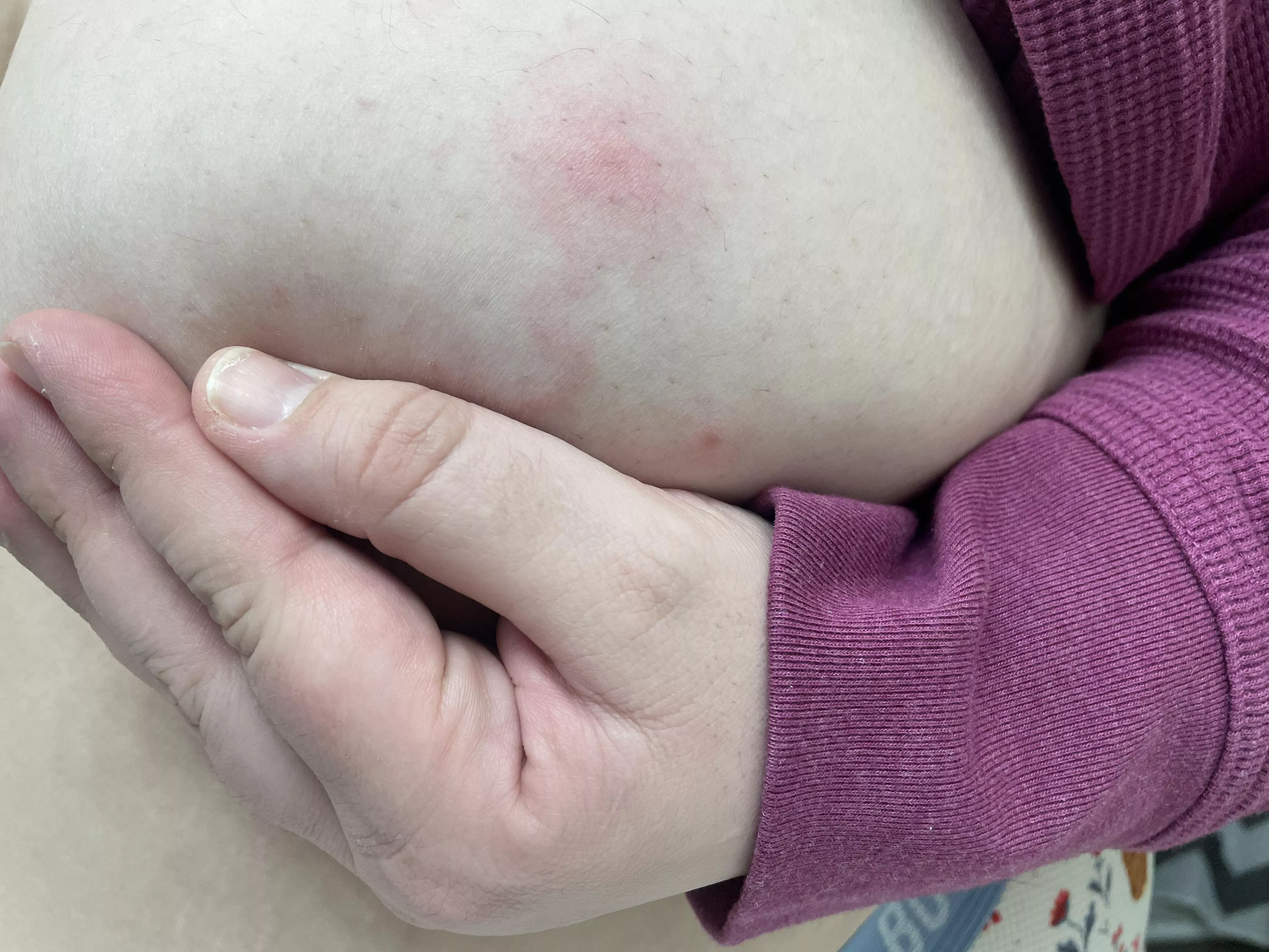 Unfortunate and now forbidden boob pop posted by cat_coven