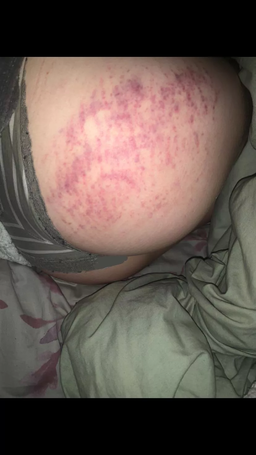 24 hours later, love the colour 😌 posted by zygolex4