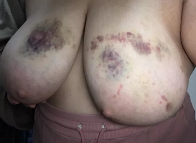 Do you wish it was worse? by Efficient_Slut2001