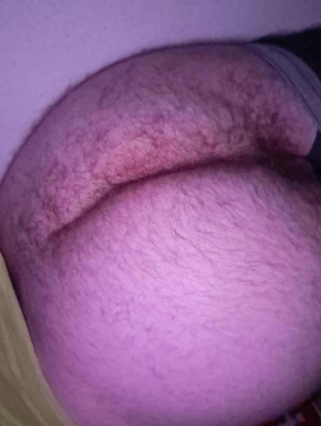 Is it good or should I trim? posted by Sebhe0l